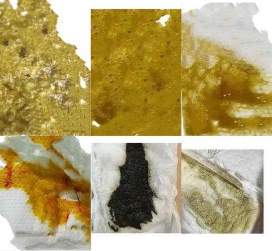 新生儿大便有粘液和奶瓣是消化不良还是生病了？-第1张图片-郑州医学网