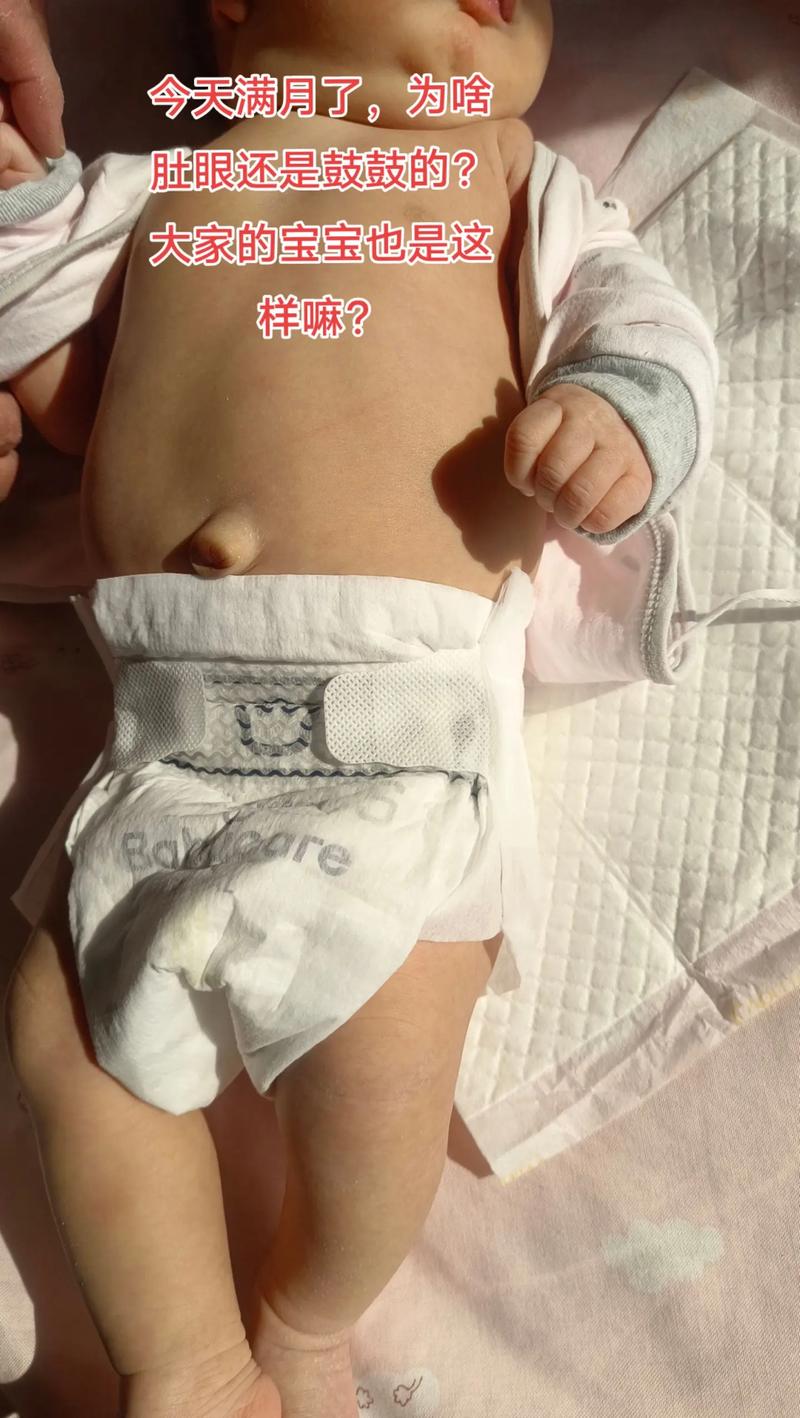 新生儿肚脐有臭味是感染了吗？该怎么护理才能避免问题？-第2张图片-郑州医学网