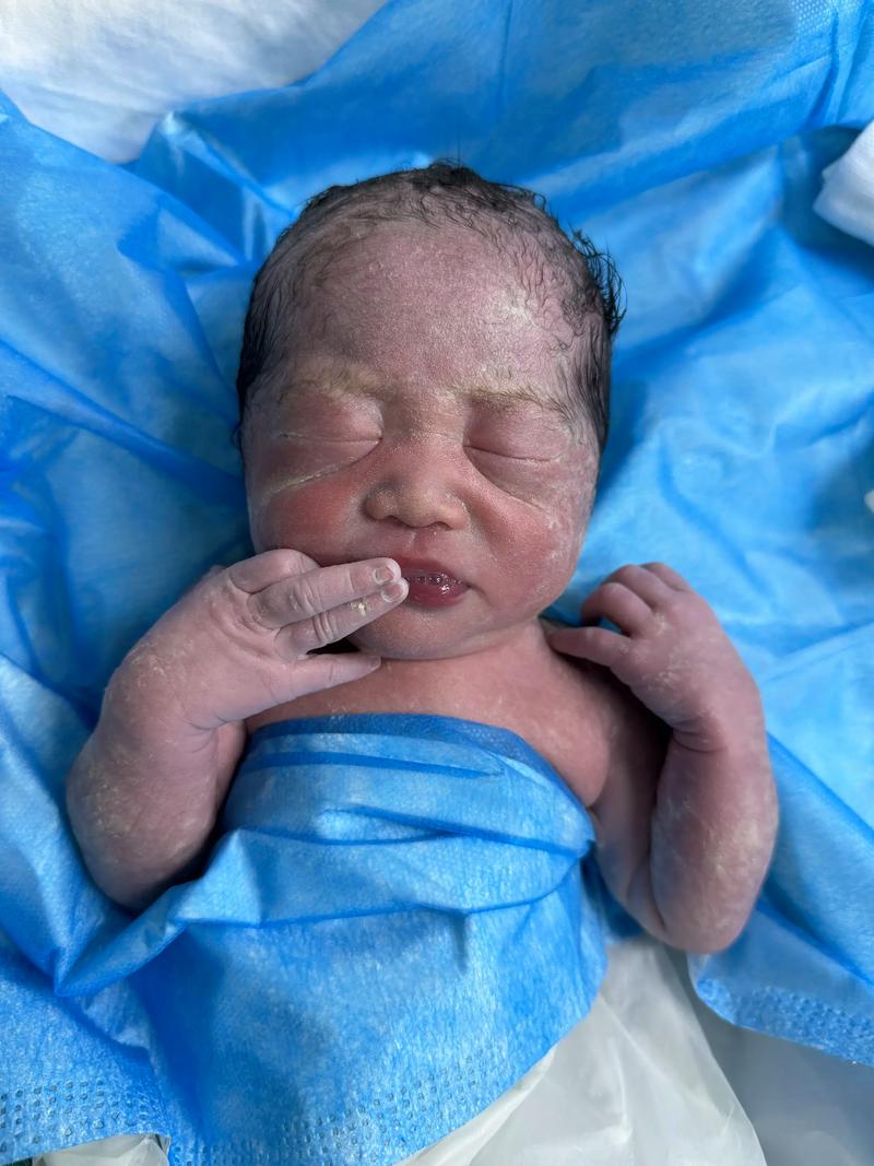 孕期焦虑症会影响宝宝健康吗?如何降低这种影响?-第1张图片-郑州医学网 孕期焦虑症会影响宝宝健康吗?如何降低这种影响?-第1张图片-郑州医学网