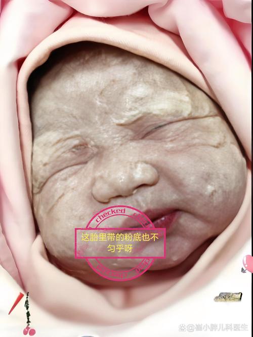 孕期焦虑症会影响宝宝健康吗?如何降低这种影响?-第2张图片-郑州医学网 孕期焦虑症会影响宝宝健康吗?如何降低这种影响?-第2张图片-郑州医学网