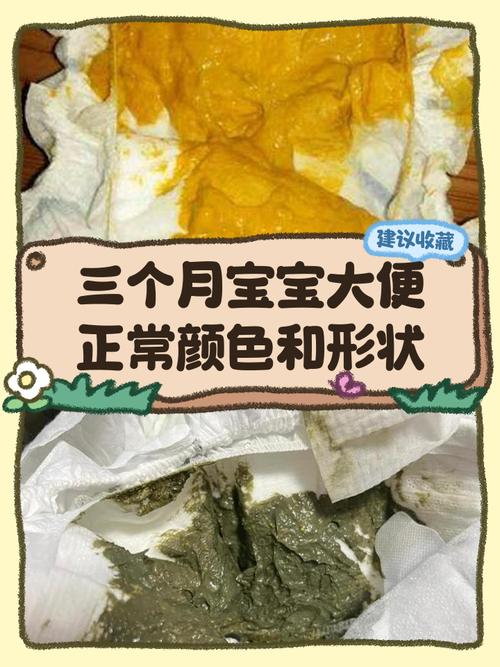 5天新生儿放屁不大便，是攒肚还是肠道有问题？需要担心吗？-第3张图片-郑州医学网