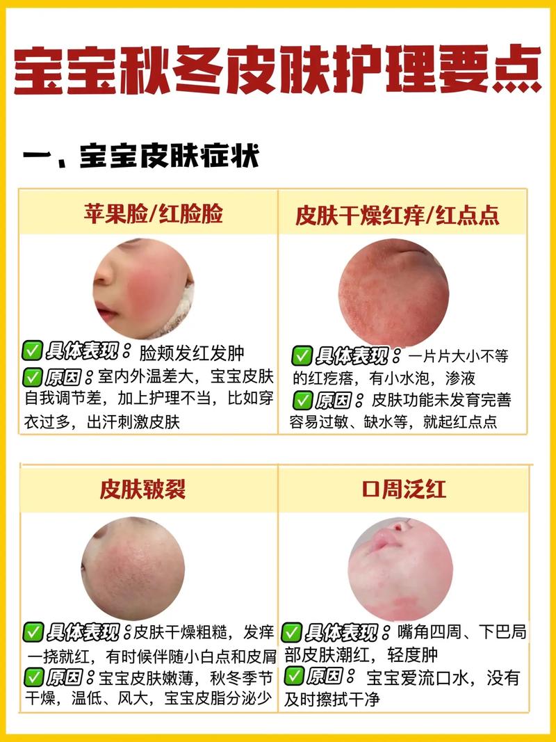 新生儿皮肤红后变白是正常现象吗?需要关注哪些异常情况?-第3张图片-郑州医学网 新生儿皮肤红后变白是正常现象吗?需要关注哪些异常情况?-第3张图片-郑州医学网