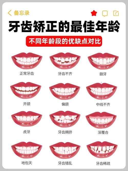 备孕期间矫正牙齿安全吗？对孕期及胎儿健康有潜在影响吗？-第2张图片-郑州医学网