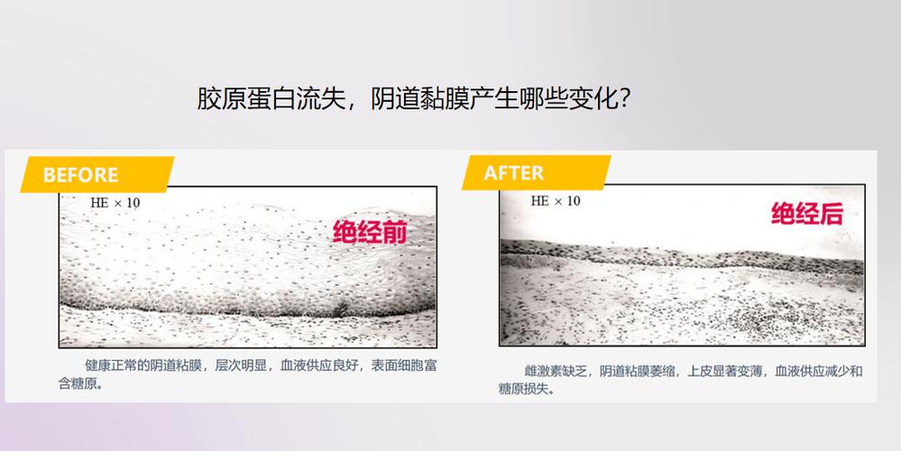 备孕期出现褐色分泌物是正常现象吗？需要立即就医检查吗？-第2张图片-郑州医学网