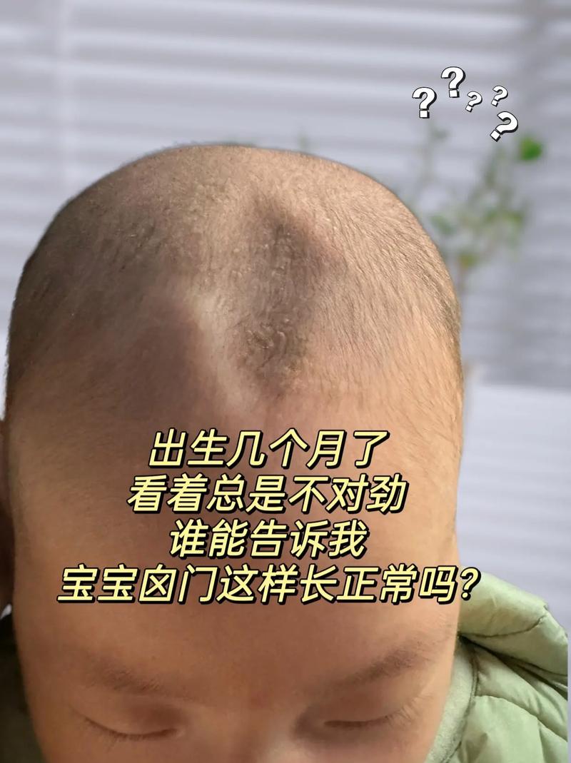 新生儿锁骨不对称图片是正常现象吗？需要就医检查吗？-第2张图片-郑州医学网