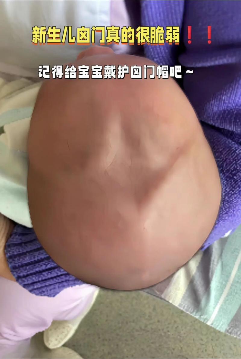 新生儿锁骨不对称图片是正常现象吗？需要就医检查吗？-第3张图片-郑州医学网
