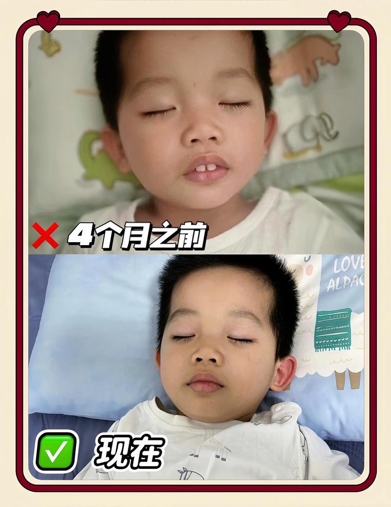 新生儿睡觉总张嘴吐舌头是正常现象还是健康预警？-第2张图片-郑州医学网