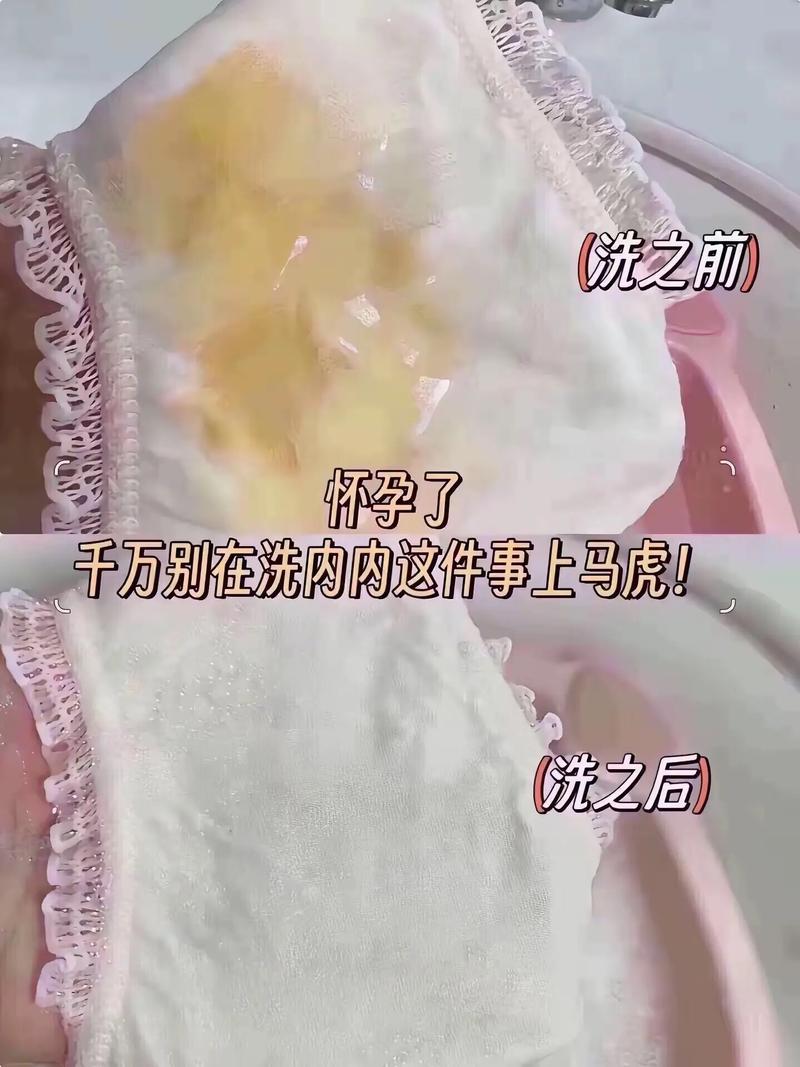 早孕白带增多是正常生理反应还是异常信号？-第3张图片-郑州医学网