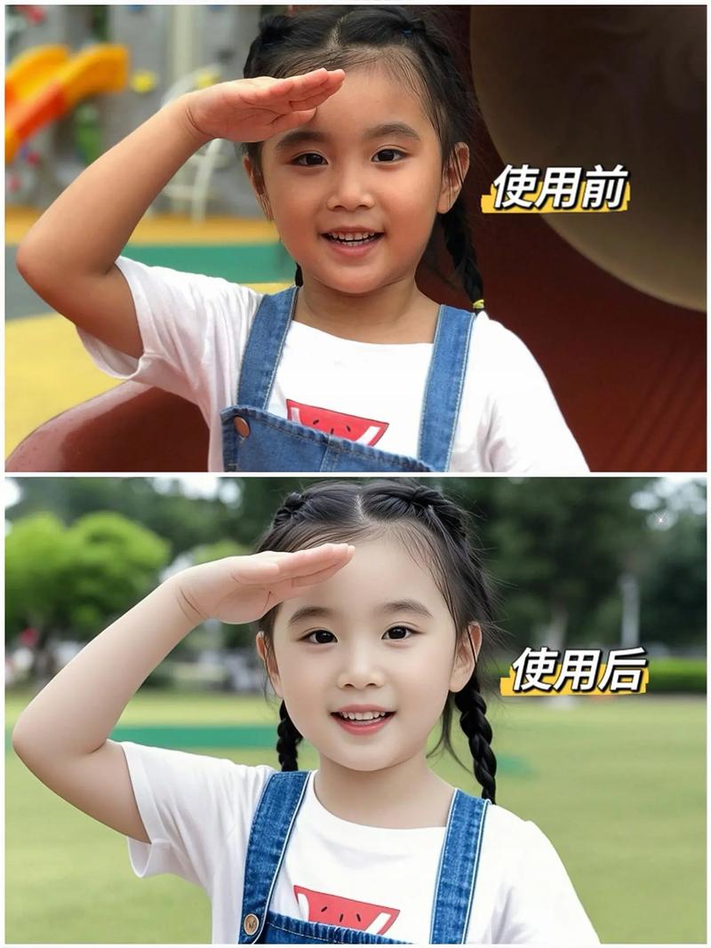 新生儿晒伤后多久能恢复？需要家长注意哪些护理细节才能促进愈合？-第2张图片-郑州医学网