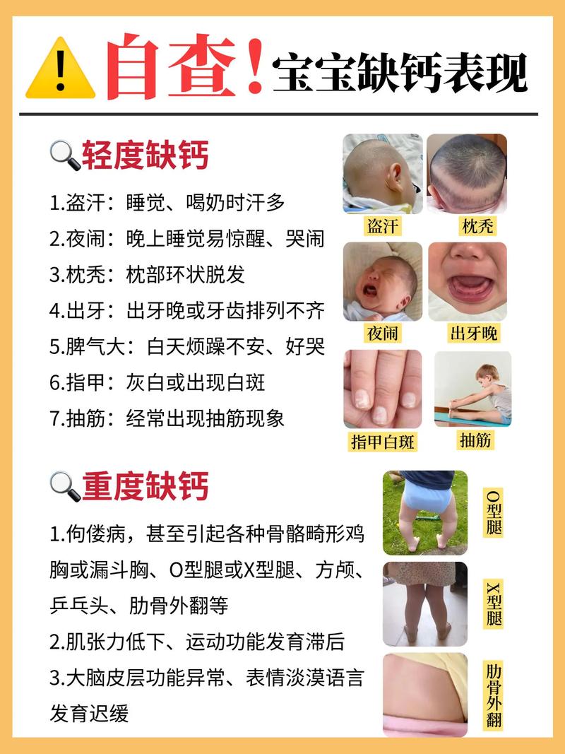 新生儿几个月开始补钙最科学？不同阶段宝宝钙需求差异与补钙指南解析-第2张图片-郑州医学网