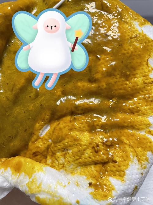 新生儿大便出现丝条状物是正常现象还是消化异常信号?-第1张图片-郑州医学网 新生儿大便出现丝条状物是正常现象还是消化异常信号?-第1张图片-郑州医学网