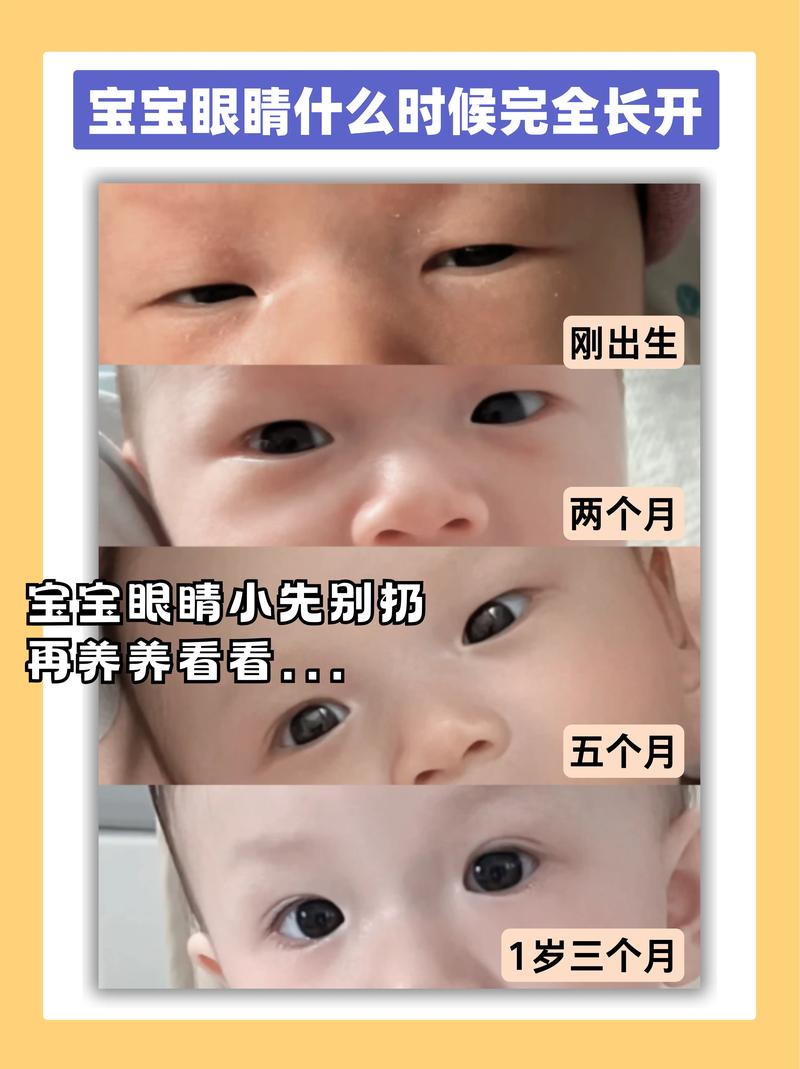 新生儿洗脸擦眼睛的正确方法与注意事项是什么？-第3张图片-郑州医学网