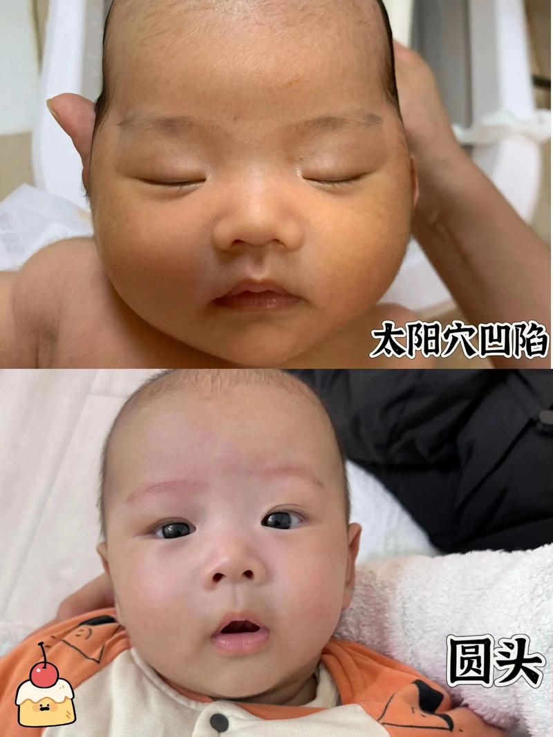 新生儿脑密度低是否严重？会影响智力发育吗？-第3张图片-郑州医学网