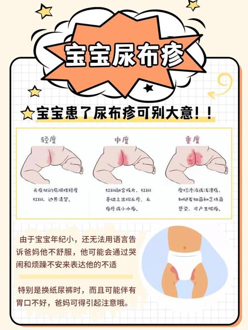 新生儿尿路感染的症状-第1张图片-郑州医学网