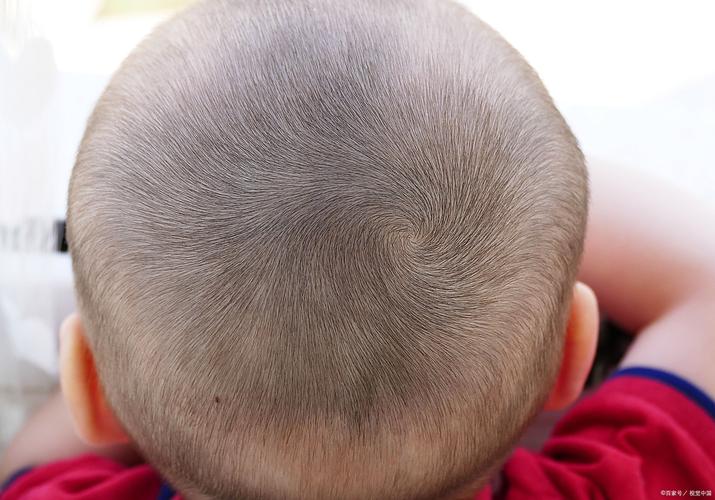 新生儿后脑勺骨头不平是缺钙还是发育异常？需要干预吗？-第1张图片-郑州医学网
