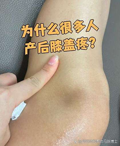 怀孕期间膝盖关节疼痛，是孕期正常反应还是身体发出的健康警报？-第2张图片-郑州医学网