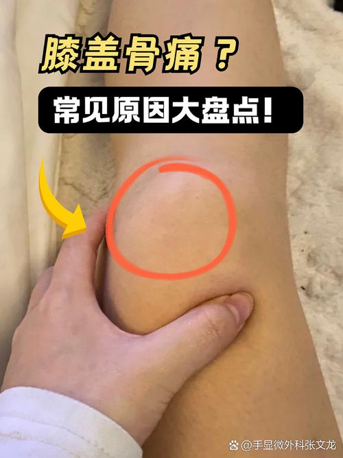 怀孕期间膝盖关节疼痛，是孕期正常反应还是身体发出的健康警报？-第3张图片-郑州医学网