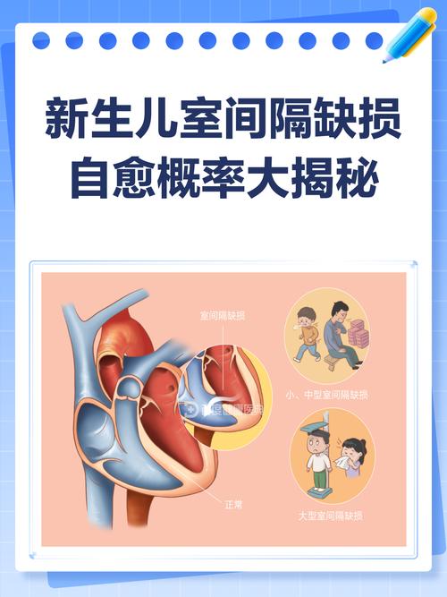 新生儿室间隔缺损肌部-第2张图片-郑州医学网