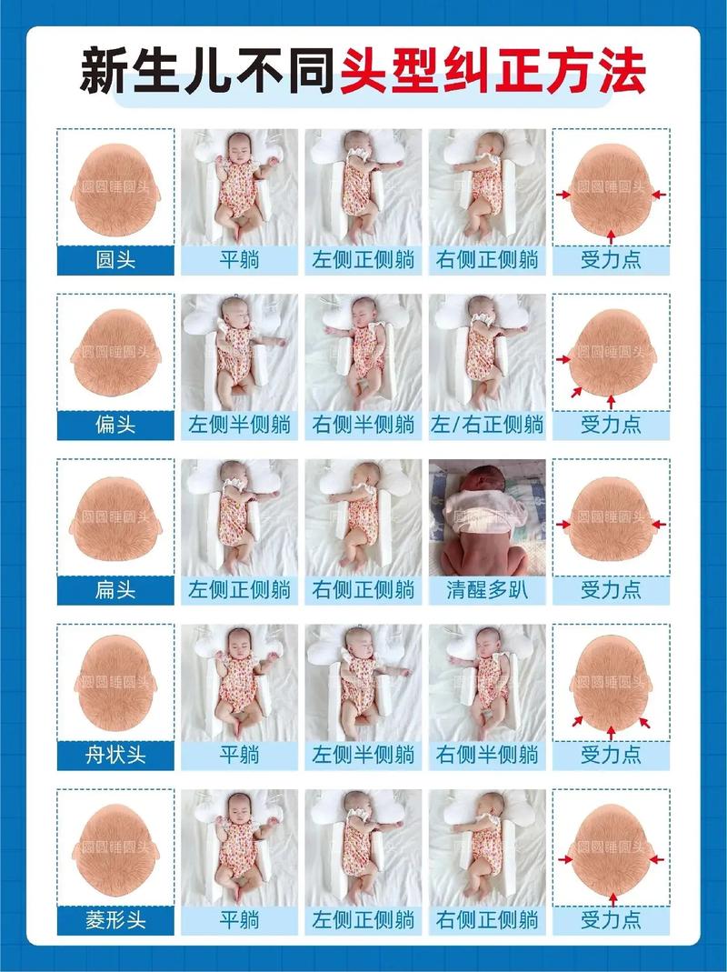 新生儿怎么睡出好头型?不同睡姿、枕头选择与护理技巧全解析!-第2张图片-郑州医学网 新生儿怎么睡出好头型?不同睡姿、枕头选择与护理技巧全解析!-第2张图片-郑州医学网