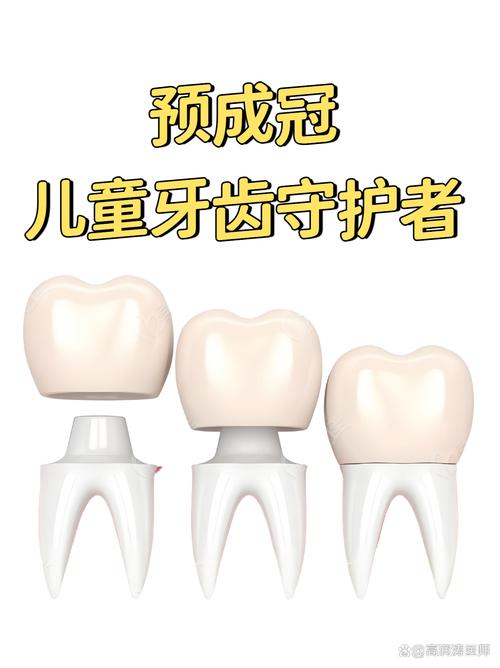 儿童做牙冠一颗费用是多少？不同材质、地区差异大吗？-第3张图片-郑州医学网