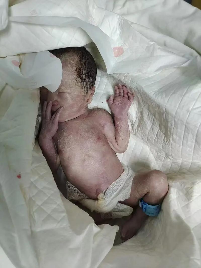 孕期输头孢致胎儿畸形,责任认定与医疗风险如何厘清?-第1张图片-郑州医学网 孕期输头孢致胎儿畸形,责任认定与医疗风险如何厘清?-第1张图片-郑州医学网