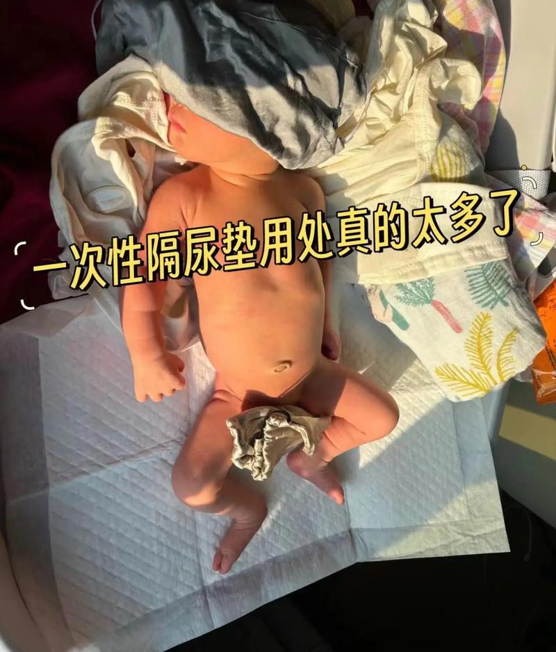 新生儿双肾分离是异常信号吗？需要干预吗？-第1张图片-郑州医学网