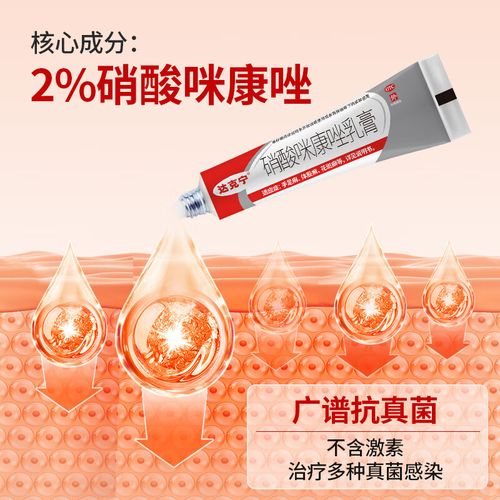 孕期长了脚气到底能不能擦达克宁？对胎儿有影响吗？-第2张图片-郑州医学网