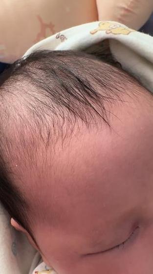 新生儿头顶看不到跳动是正常现象吗？需要担心吗？-第3张图片-郑州医学网