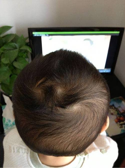 新生儿头顶看不到跳动是正常现象吗？需要担心吗？-第2张图片-郑州医学网