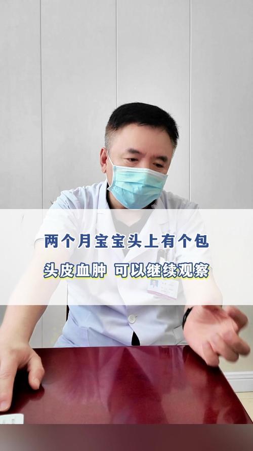 新生儿头颅血肿变硬后多久能吸收？需要特殊处理吗？-第3张图片-郑州医学网