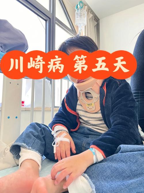 孩子疑似川崎病该挂什么科？儿童医院就诊科室全解析！-第3张图片-郑州医学网