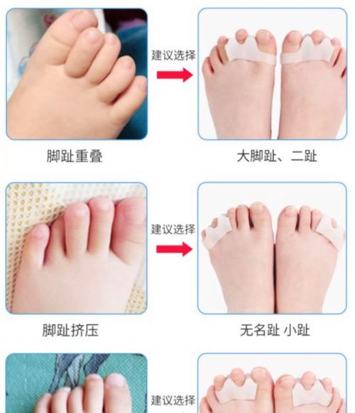 新生儿脚套的做法图解-第3张图片-郑州医学网