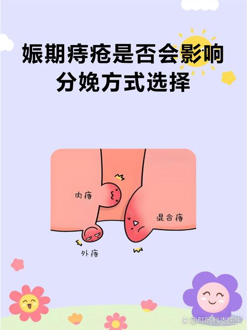 孕期痔疮究竟是如何悄悄找上门来的?-第2张图片-郑州医学网 孕期痔疮究竟是如何悄悄找上门来的?-第2张图片-郑州医学网