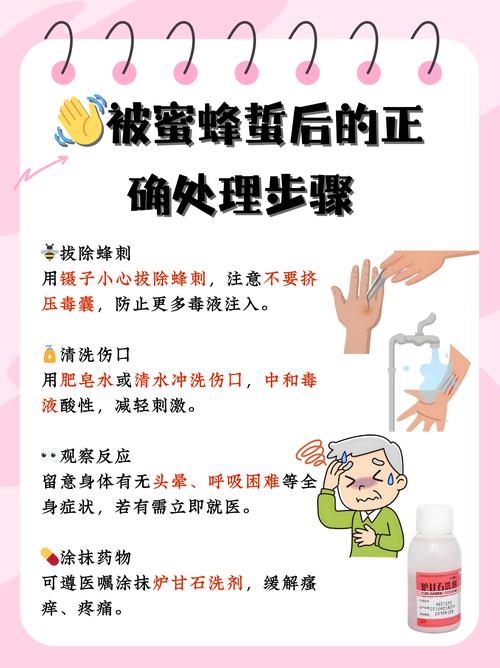儿童被蜜蜂蜇伤后，如何正确处理才能避免感染和过敏反应？-第1张图片-郑州医学网