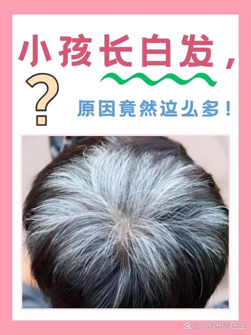 儿童长白头发是缺营养还是生病了？家长该怎么应对？-第1张图片-郑州医学网