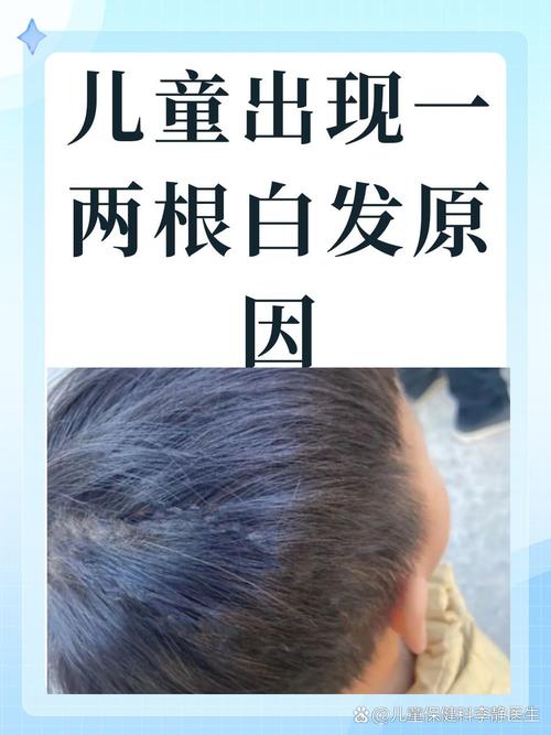 儿童长白头发是缺营养还是生病了？家长该怎么应对？-第2张图片-郑州医学网