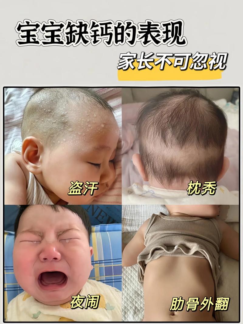 新生儿囟门大一定是缺钙吗?还有哪些可能原因需要警惕?-第1张图片-郑州医学网 新生儿囟门大一定是缺钙吗?还有哪些可能原因需要警惕?-第1张图片-郑州医学网