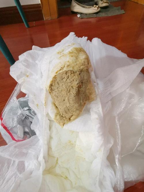 五岁儿童大便发白是消化问题还是肝胆异常？家长需警惕哪些信号？-第1张图片-郑州医学网