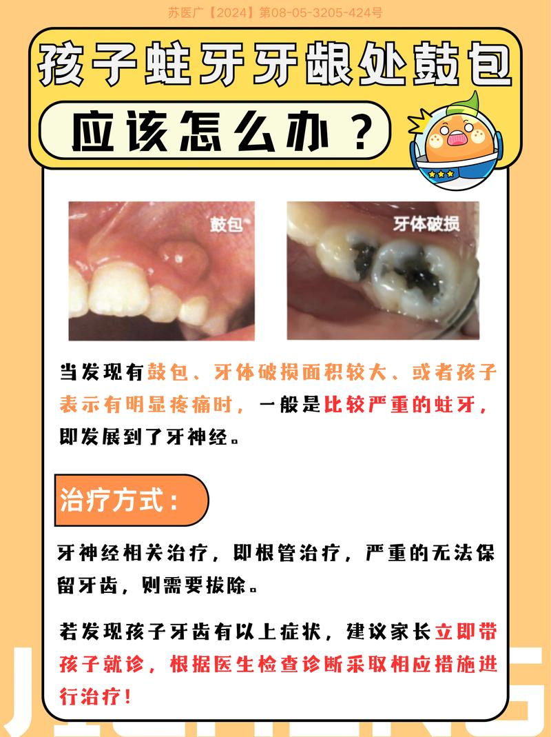 儿童牙龈鼓包怎么回事-第1张图片-郑州医学网 儿童牙龈鼓包怎么回事-第1张图片-郑州医学网
