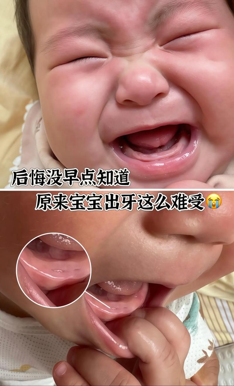 儿童牙龈鼓包怎么回事-第3张图片-郑州医学网 儿童牙龈鼓包怎么回事-第3张图片-郑州医学网