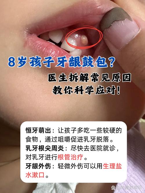 儿童牙龈鼓包怎么回事-第2张图片-郑州医学网 儿童牙龈鼓包怎么回事-第2张图片-郑州医学网