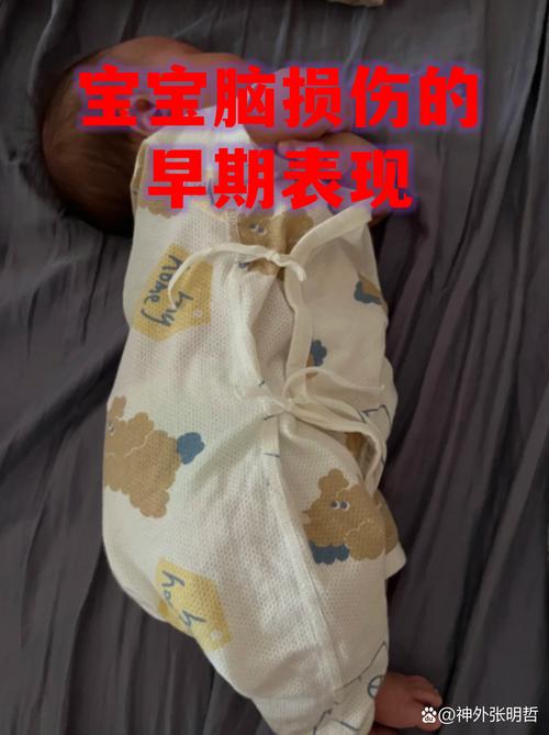 新生儿脑损伤后,大脑能否自行修复?恢复过程受哪些因素影响?家长该如何科学干预?-第2张图片-郑州医学网 新生儿脑损伤后,大脑能否自行修复?恢复过程受哪些因素影响?家长该如何科学干预?-第2张图片-郑州医学网