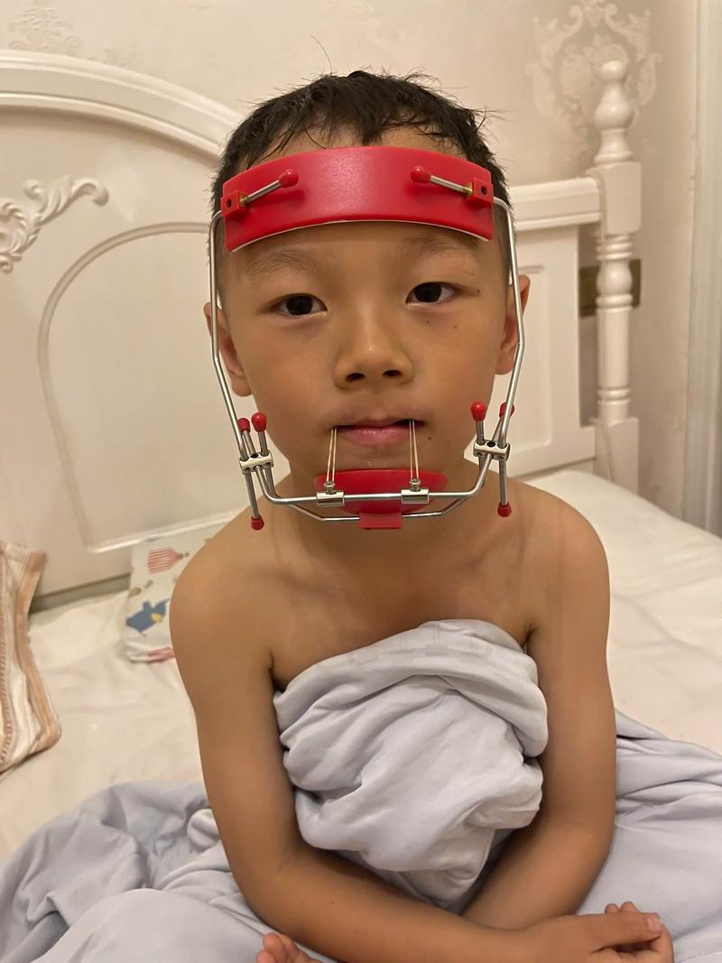 新生儿斗鸡眼是正常现象还是需要矫正？家长该如何科学应对？-第2张图片-郑州医学网