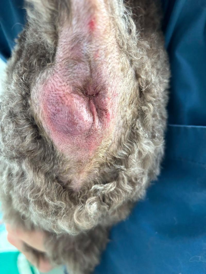 新生儿肛门上有个小洞是正常生理结构还是异常情况？需要就医处理吗？-第3张图片-郑州医学网