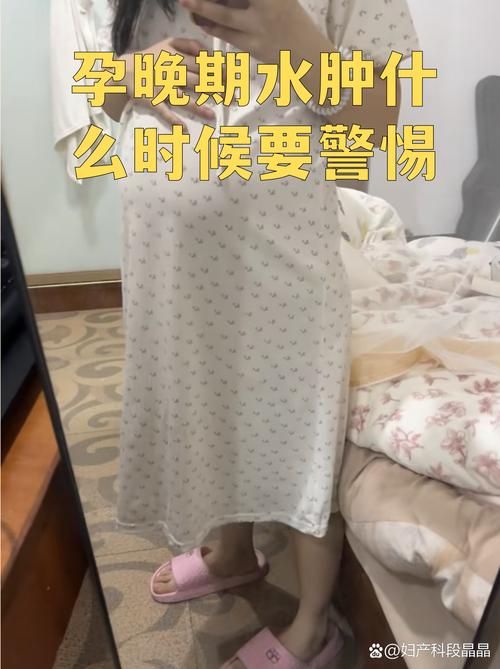 孕期浮肿通常从什么时候开始?哪些因素会加剧孕期浮肿?-第1张图片-郑州医学网 孕期浮肿通常从什么时候开始?哪些因素会加剧孕期浮肿?-第1张图片-郑州医学网