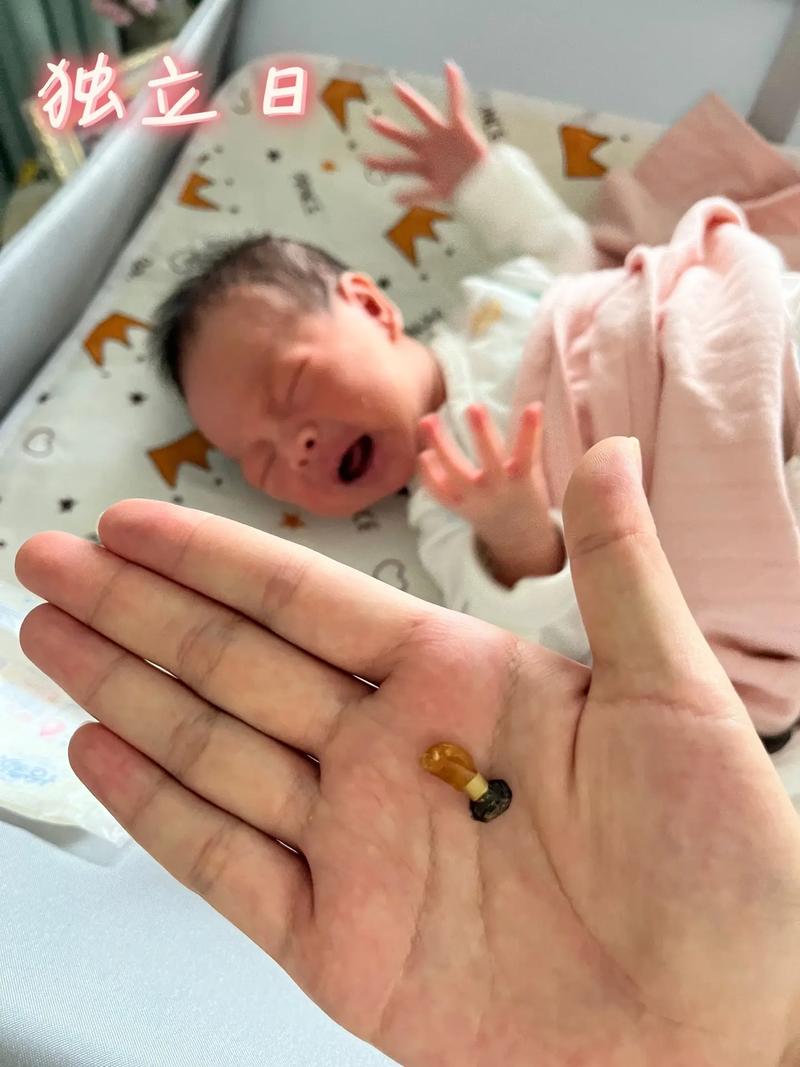 新生儿肚脐脱落后图片显示正常还是异常？如何判断护理是否得当？-第3张图片-郑州医学网