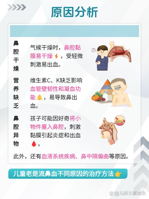 儿童频繁流鼻血是身体发出的什么健康信号？-第1张图片-郑州医学网