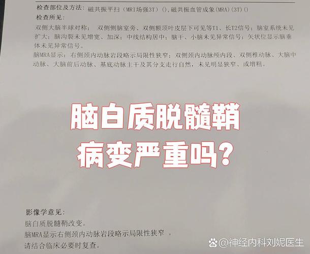 儿童脑白质脱髓鞘病变-第2张图片-郑州医学网