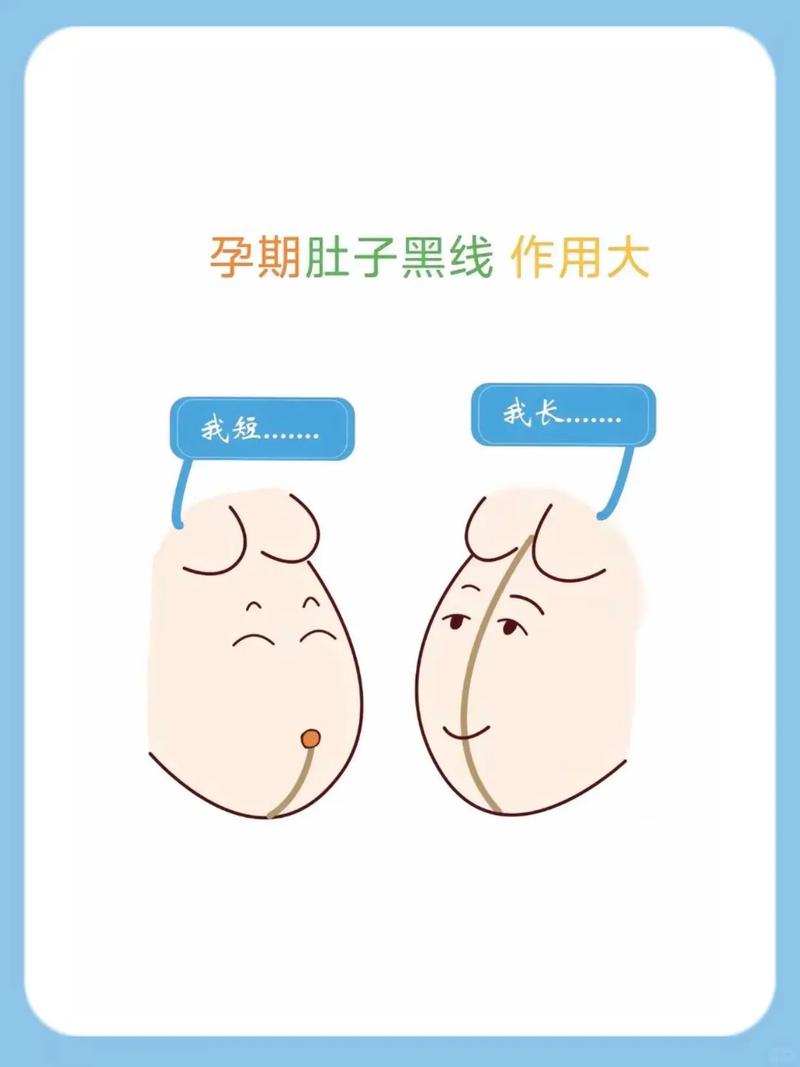 孕期肚脐发黑是正常现象还是身体异常信号？需要警惕哪些潜在健康问题？-第2张图片-郑州医学网