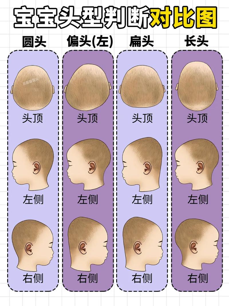 新生儿头形怎么睡好看-第2张图片-郑州医学网